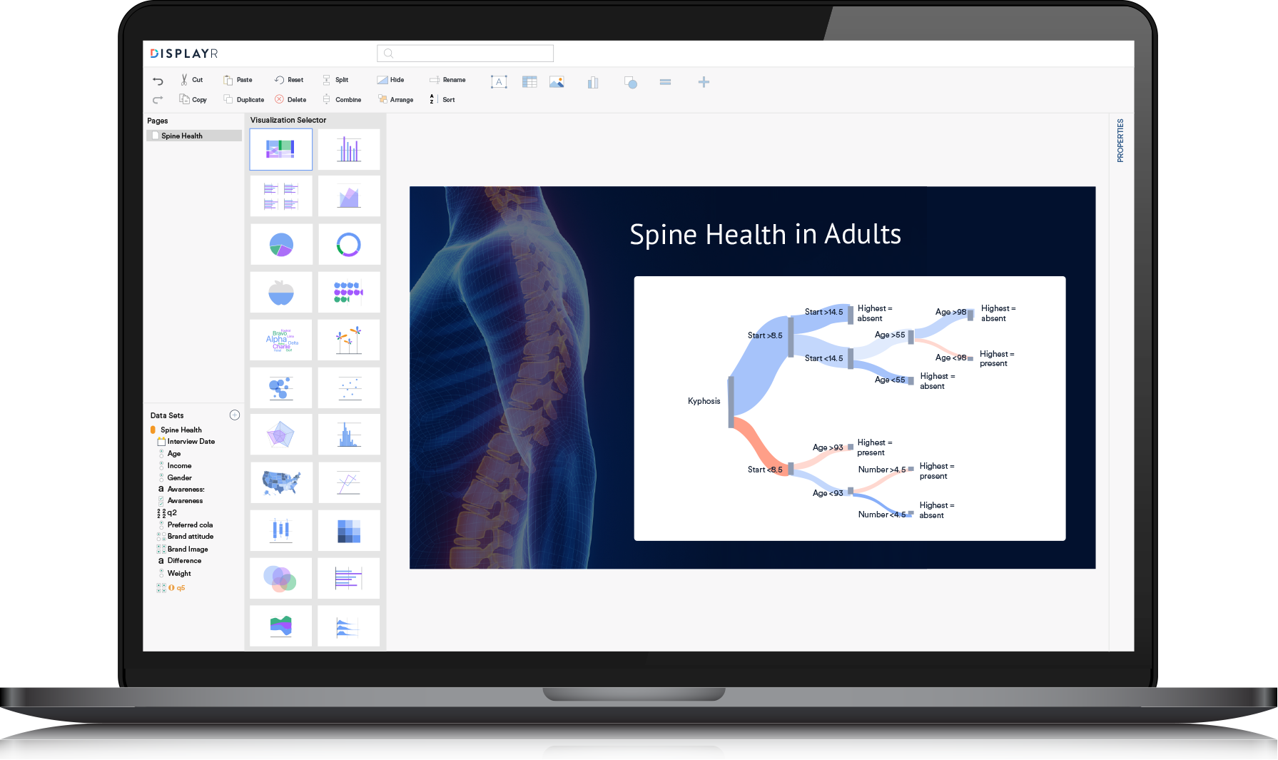 Sankey Diagram Maker in Displayr